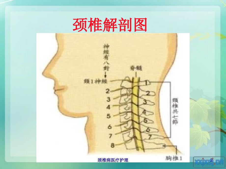 医学医疗-颈椎病医疗护理培训课件_第2页