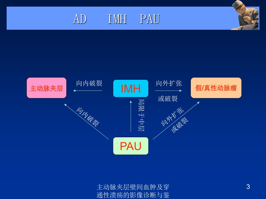 主动脉夹层壁间血肿及穿通性溃疡的影像诊断与鉴别诊断培训课件_第3页