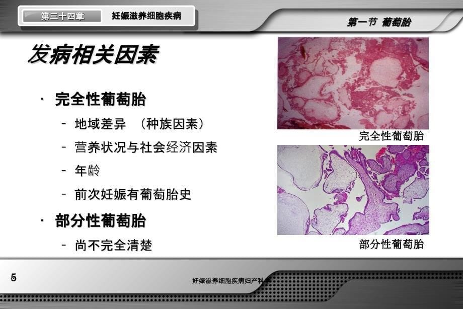 妊娠滋养细胞疾病妇产科学培训课件_第5页