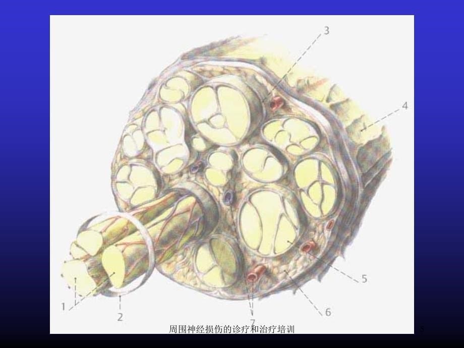 周围神经损伤的诊疗和治疗培训培训课件_第5页